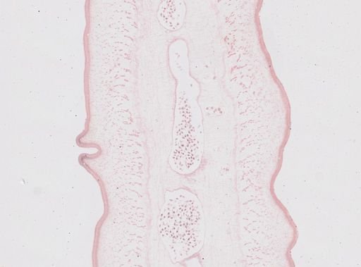Taenia saginata