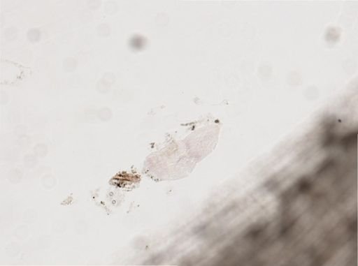 Platytrichotus
