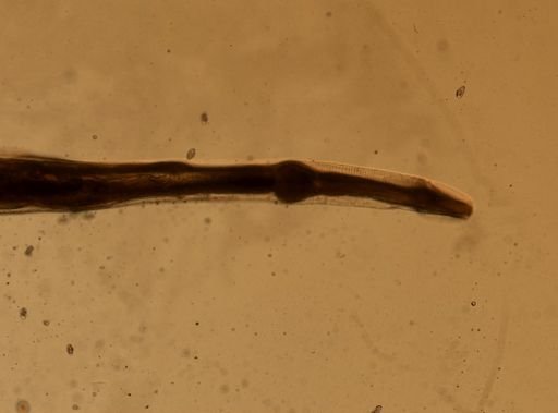 Enterobius vermicularis