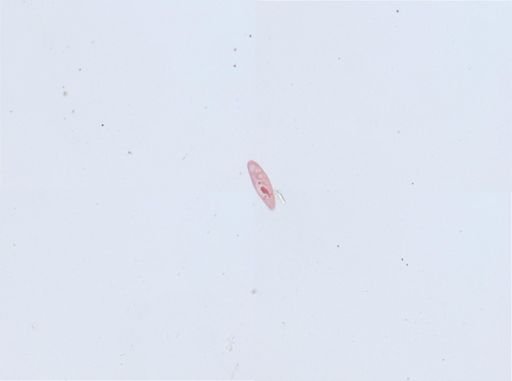 Paramecium aurelia
