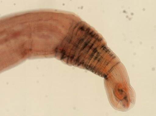 Oligacanthorhynchus microcephalus