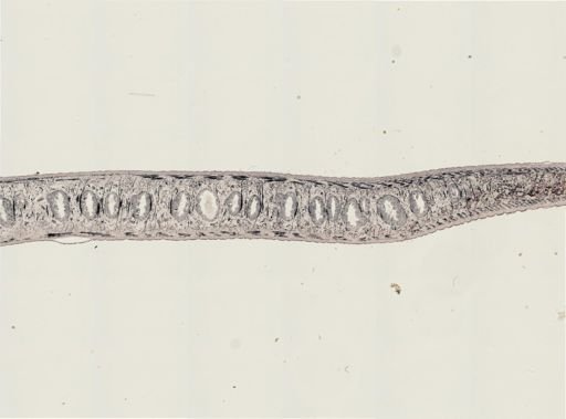 Turbellaria