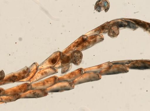 Kinetoskias smittii