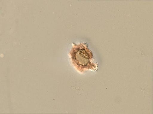 Rotifera