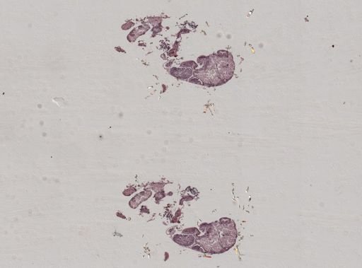 Crepidula convexa