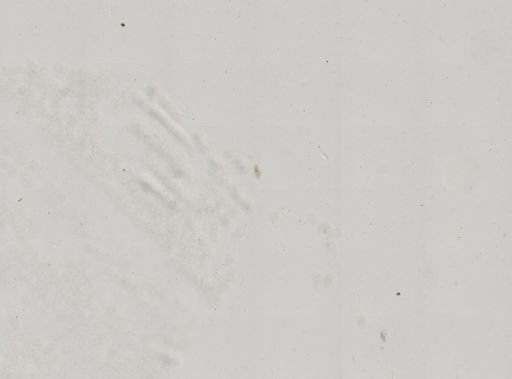 Paramecium