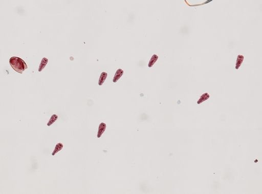 Fasciola hepatica