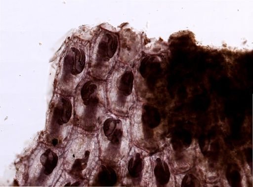 Bryozoa