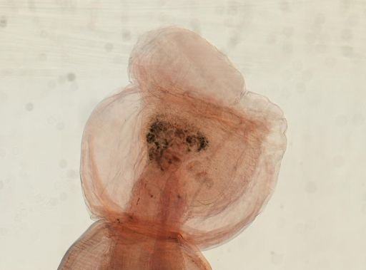 Oligacanthorhynchus microcephalus