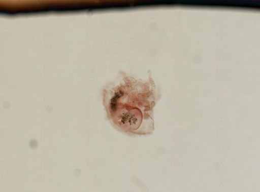 Cnidaria