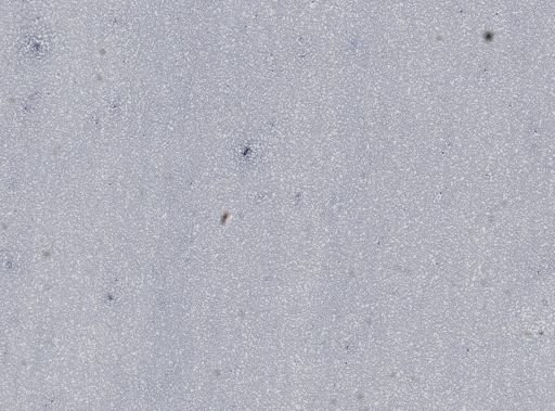 Plasmodium vivax