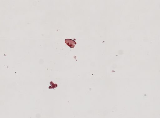 Fasciola hepatica