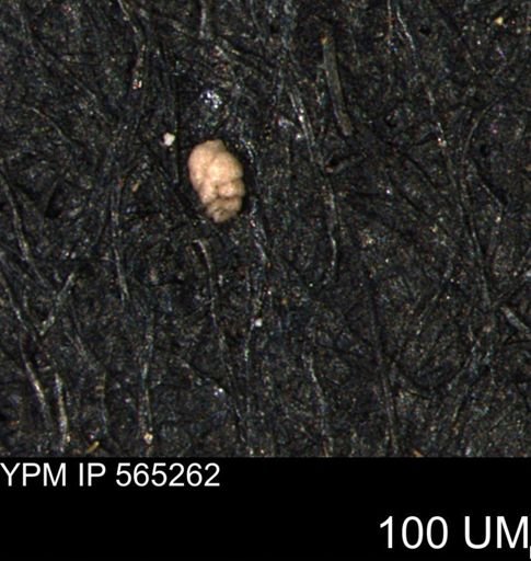 Spirolocammina planula