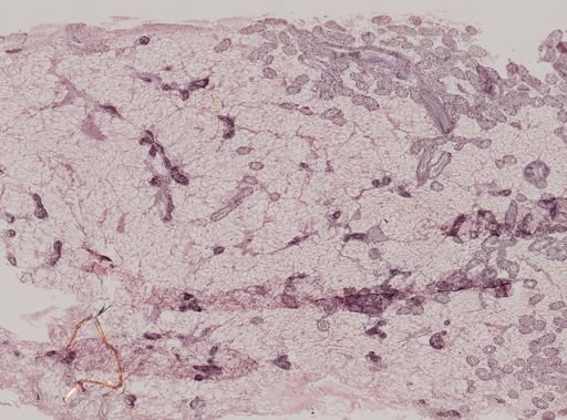 Modiolus
