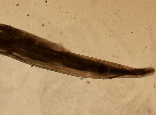 Enterobius vermicularis