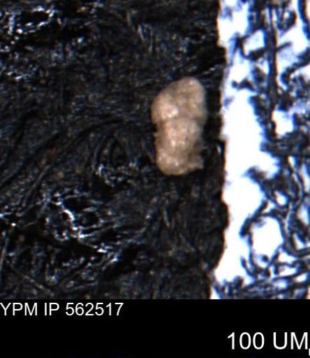 Verneuilina canadensis