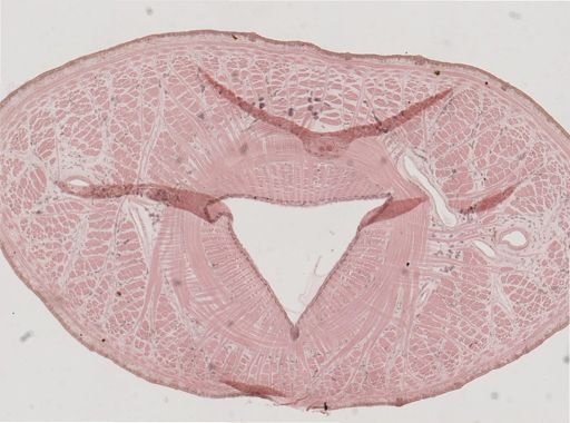 Erpobdella punctata