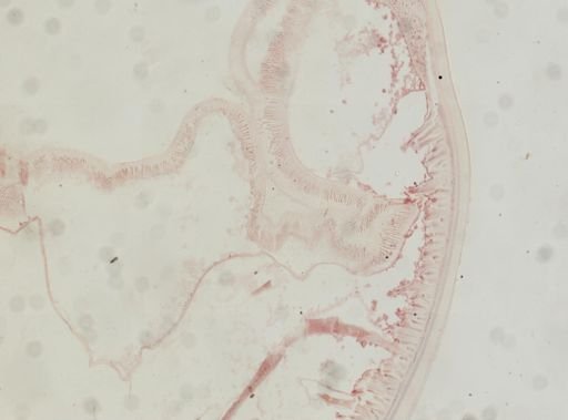 Ascaris megalocephala