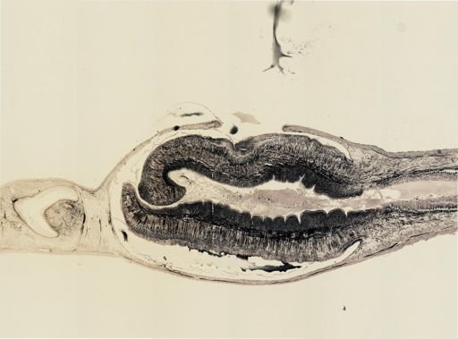 Turbellaria