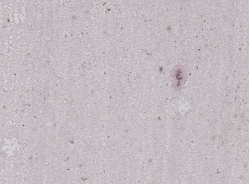 Haemoproteus