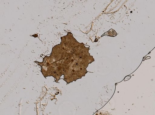 Ankistrodesmus