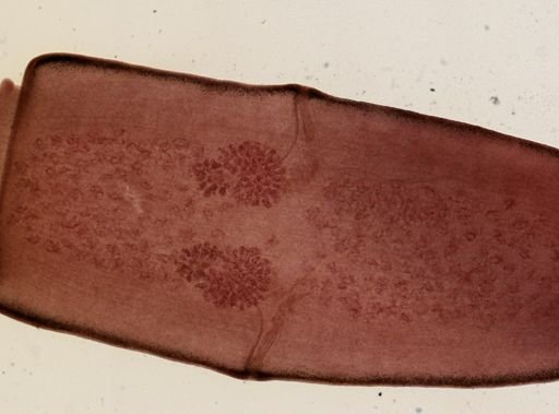 Dipylidium caninum