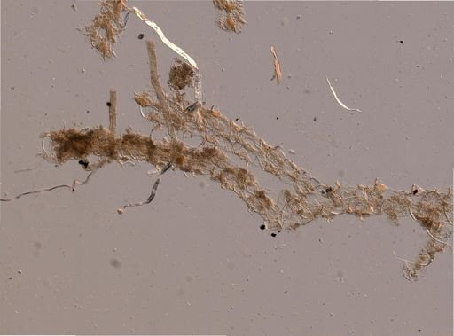 Scrupocellaria scruposa