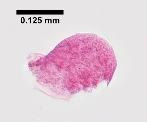 Hyalella