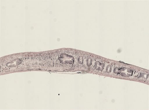 Turbellaria