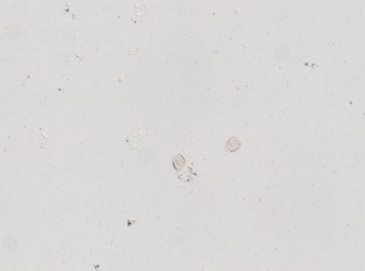 Trichuris vulpis