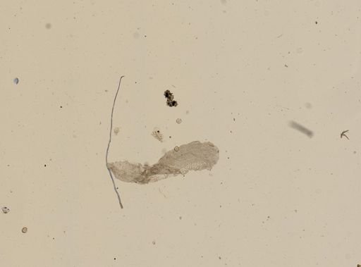 Hymenolepis nana