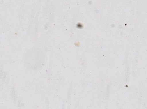 Strongyloides stercoralis