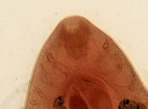 Fasciola hepatica