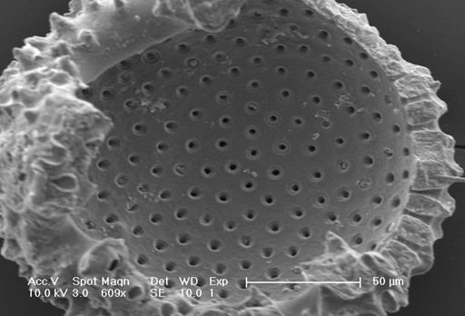 Globigerinoides ruber