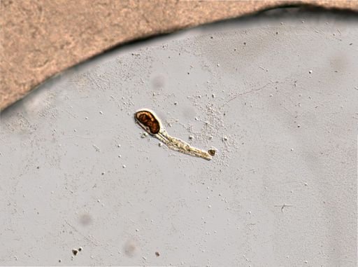 Rotifera