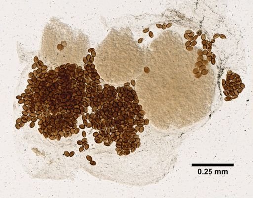 Dicrocoelium dendriticum