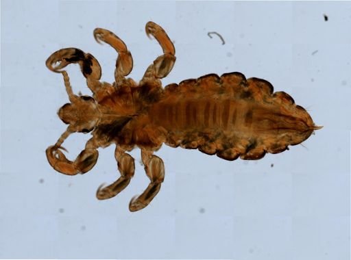 Pediculus humanus