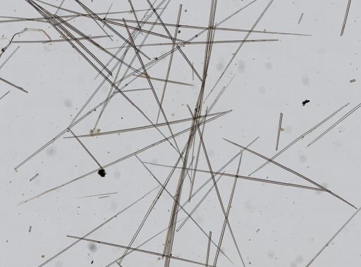 Tentorium semisuberites