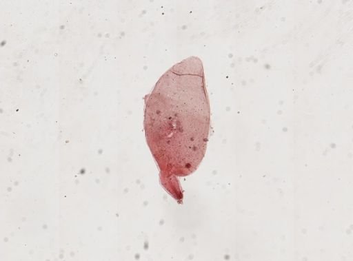 Dendrocometes paradoxus