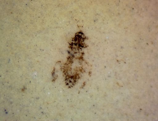 undet. Hexapoda