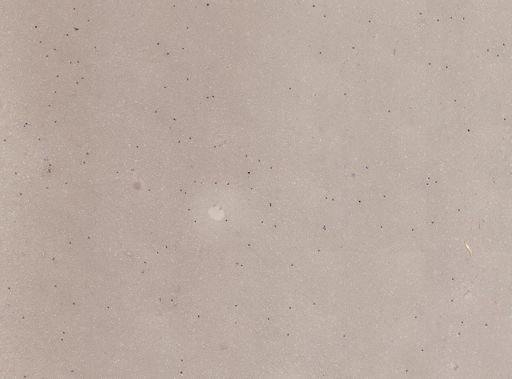 Plasmodium falciparum