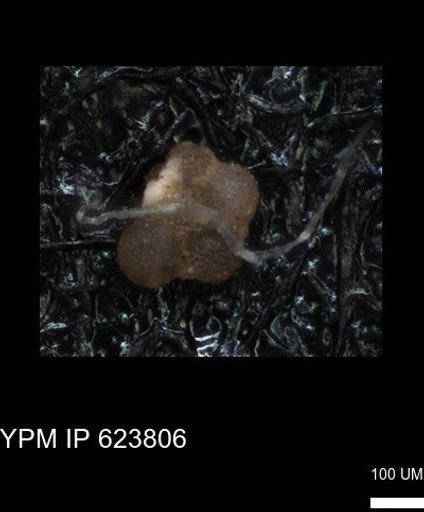 undet. Rugoglobigerinidae