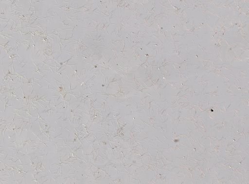 Plakortis zyggompha