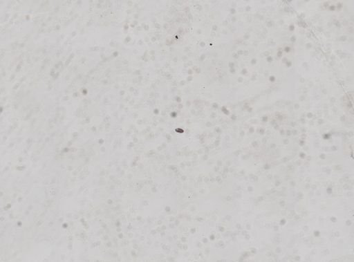 Paramecium
