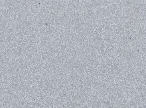 Plasmodium vivax