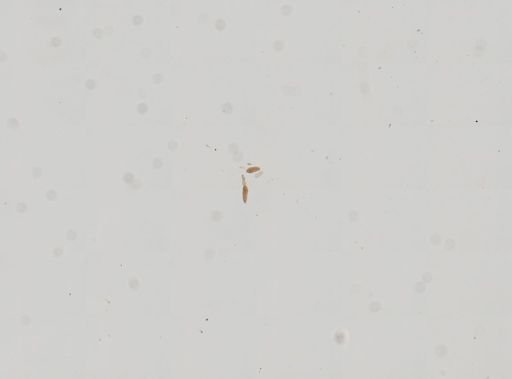 Schistosoma mansoni