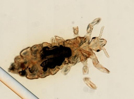 Pediculus humanus