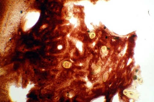 Aiolochroia crassa