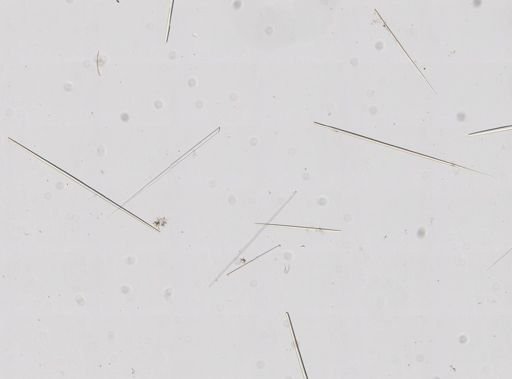 Tethya seychellensis