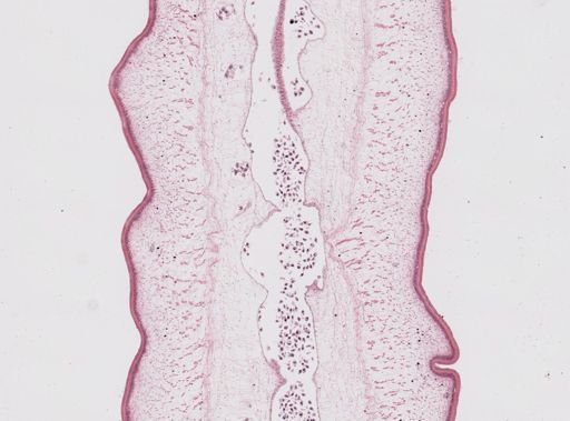 Taenia saginata